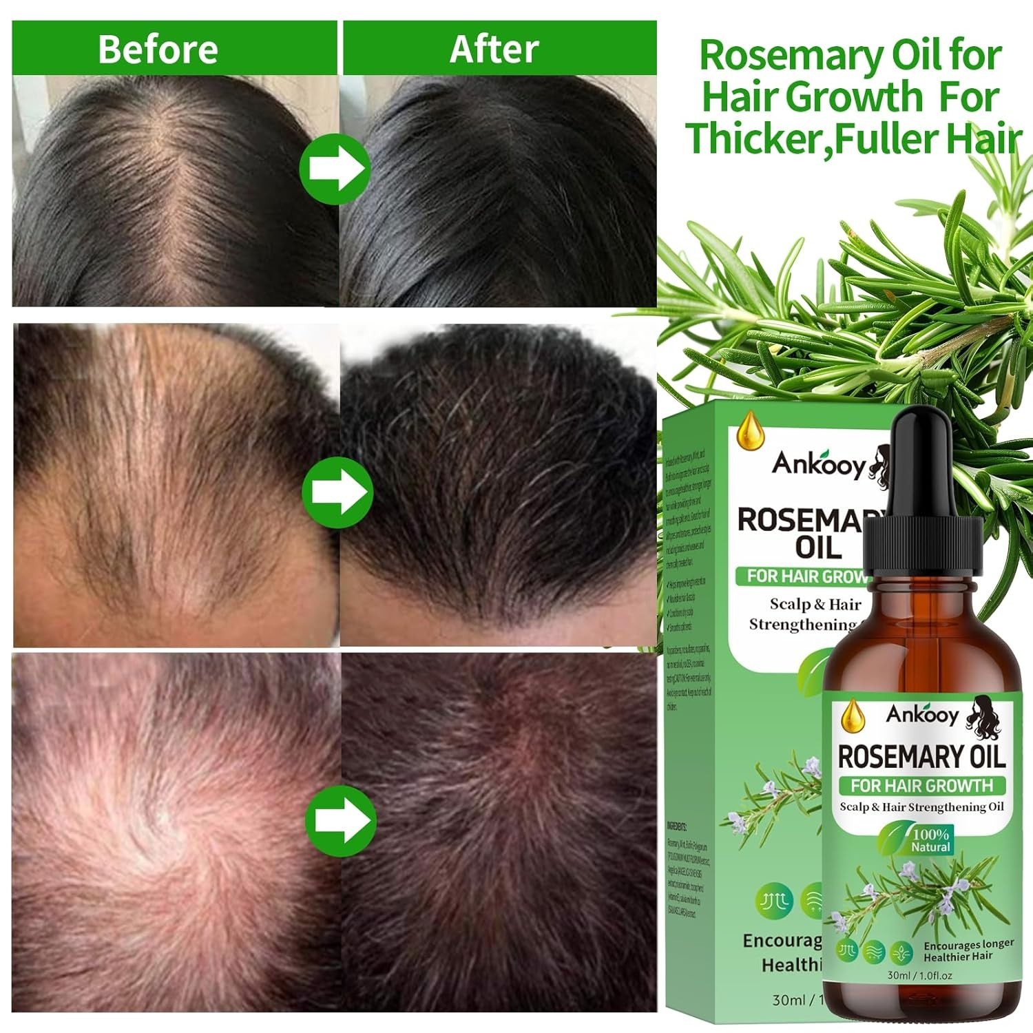 3 Pack Rosemary Oil for Hair Growth,Rosemary Hair Growth Oil,Strengthening Oil f