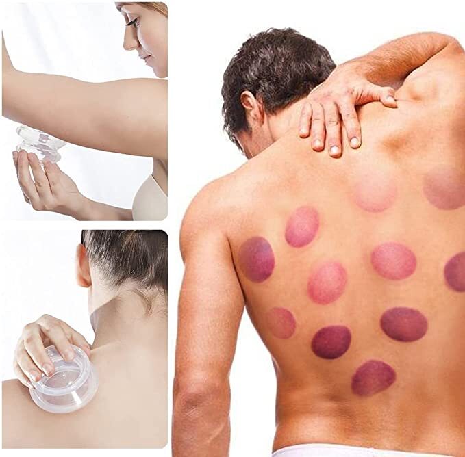 2 Cups Cupping Therapy Set Silicone Suction Vacuum Massage For Face Full Body US