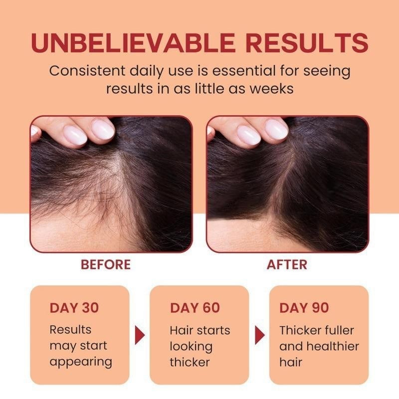 Raw Batana Oil Honduras 100% Pure Unrefined Hair Growth Scalp Treatment Dr Sebi