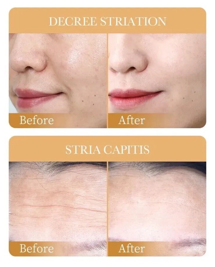 10pcs Anti-Wrinkle Collagen Face Mask Moisturizing Anti-Aging Repair Brightening