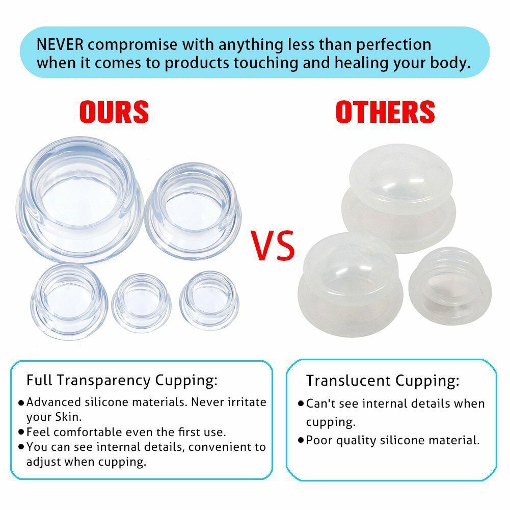 2 Cups Cupping Therapy Set Silicone Suction Vacuum Massage For Face Full Body US