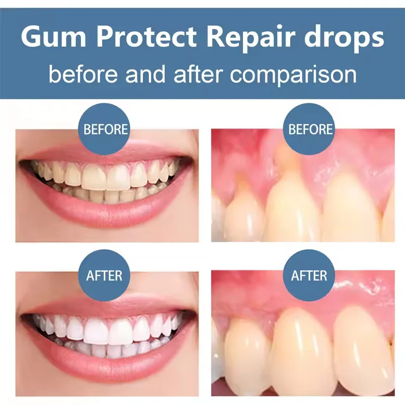 Hot Damaged Gum Repair Care Gel Relieve Sore Gums Serum Dental Caries Toothpaste