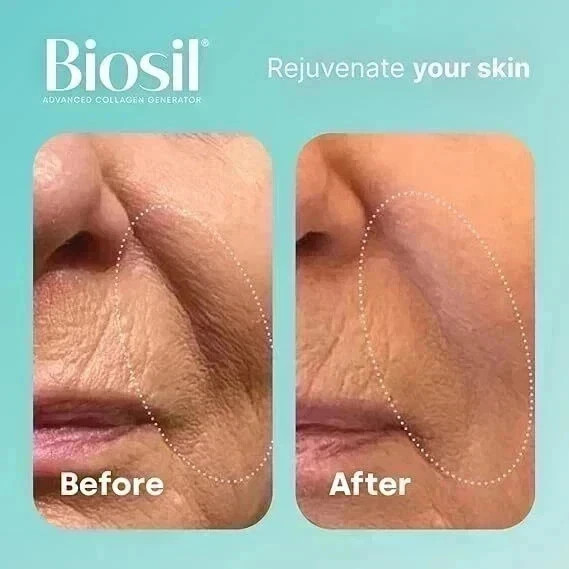 Biosil Collagen Generator – 120 Original Capsules ( pack of 2 )