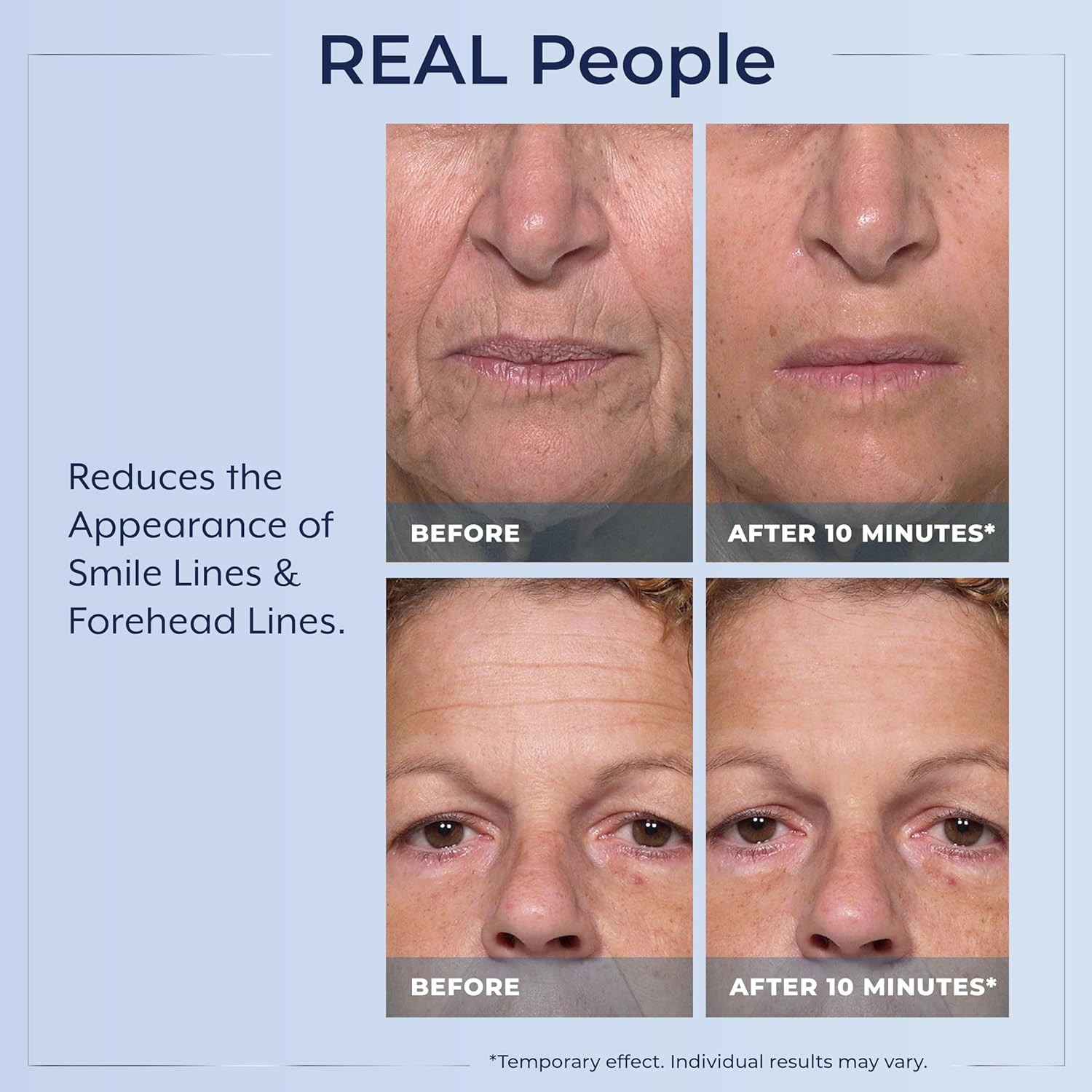 Plexaderm Rapid Reduction Eye Serum – Visibly Reduces Under-Eye Bags, Wrinkles~