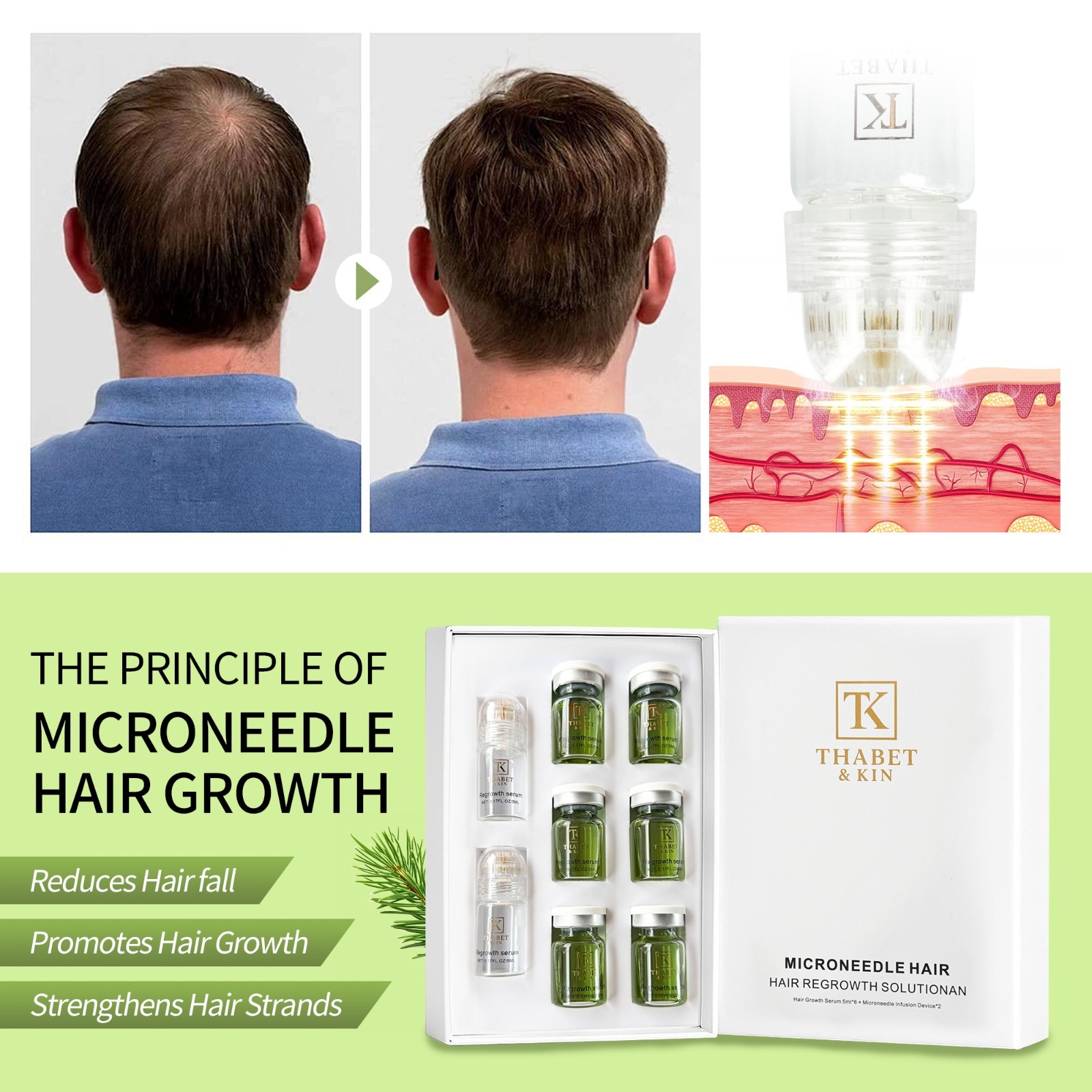 Thabet & KIN Hair Regrowth System, Advanced Hair Growth Treatment USA Brand FAST