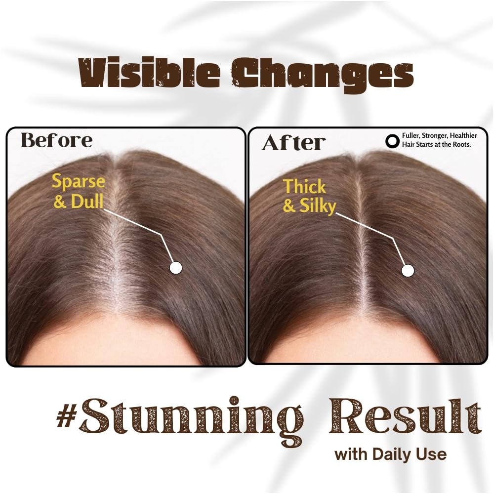 Rosemary Oil For Hair Growth (3.4 Fl Oz) Infused With Biotin, Vitamin E, Almo…