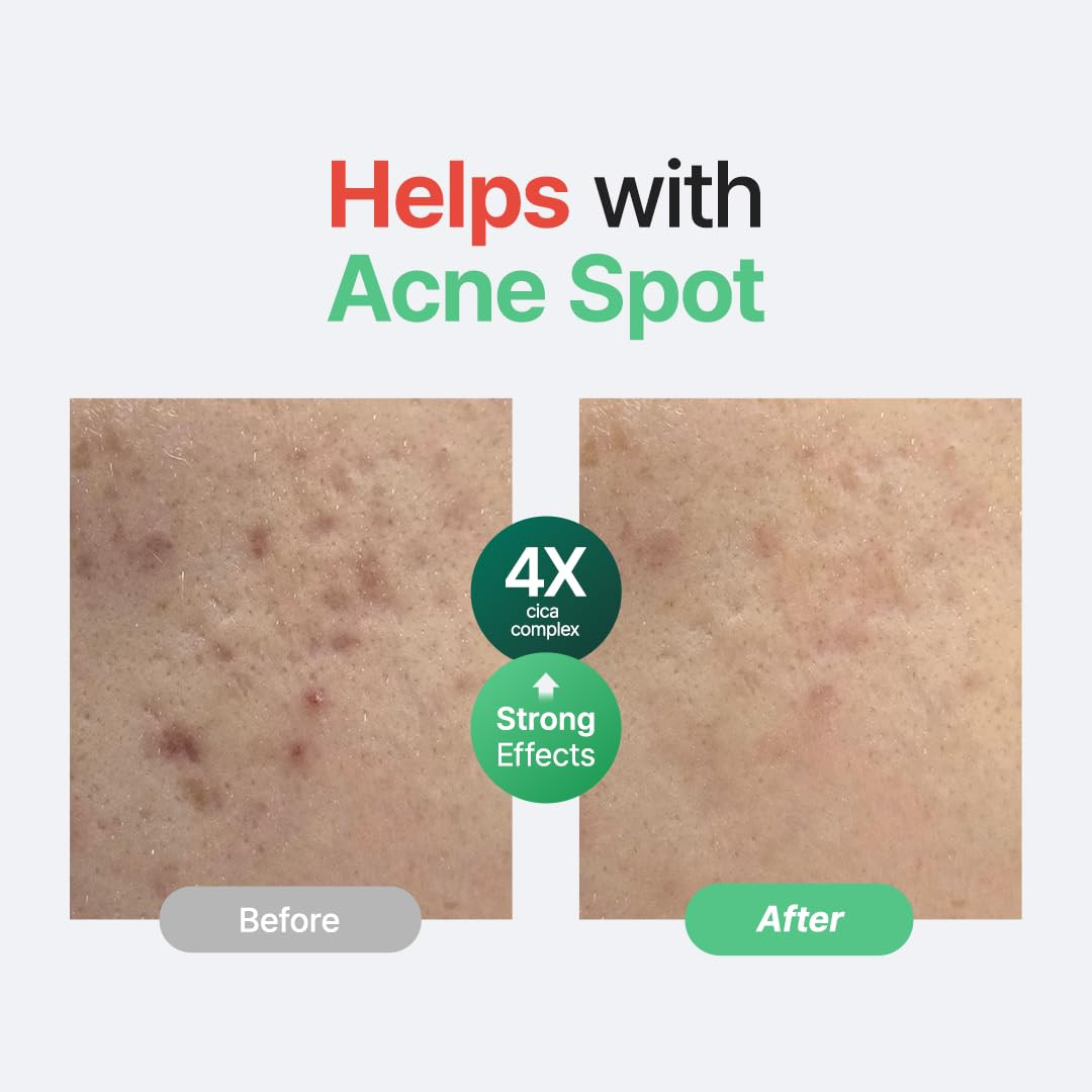 Centella Unscented Serum for Sensitive Skin – Lightweight Calming & Skin Barrier