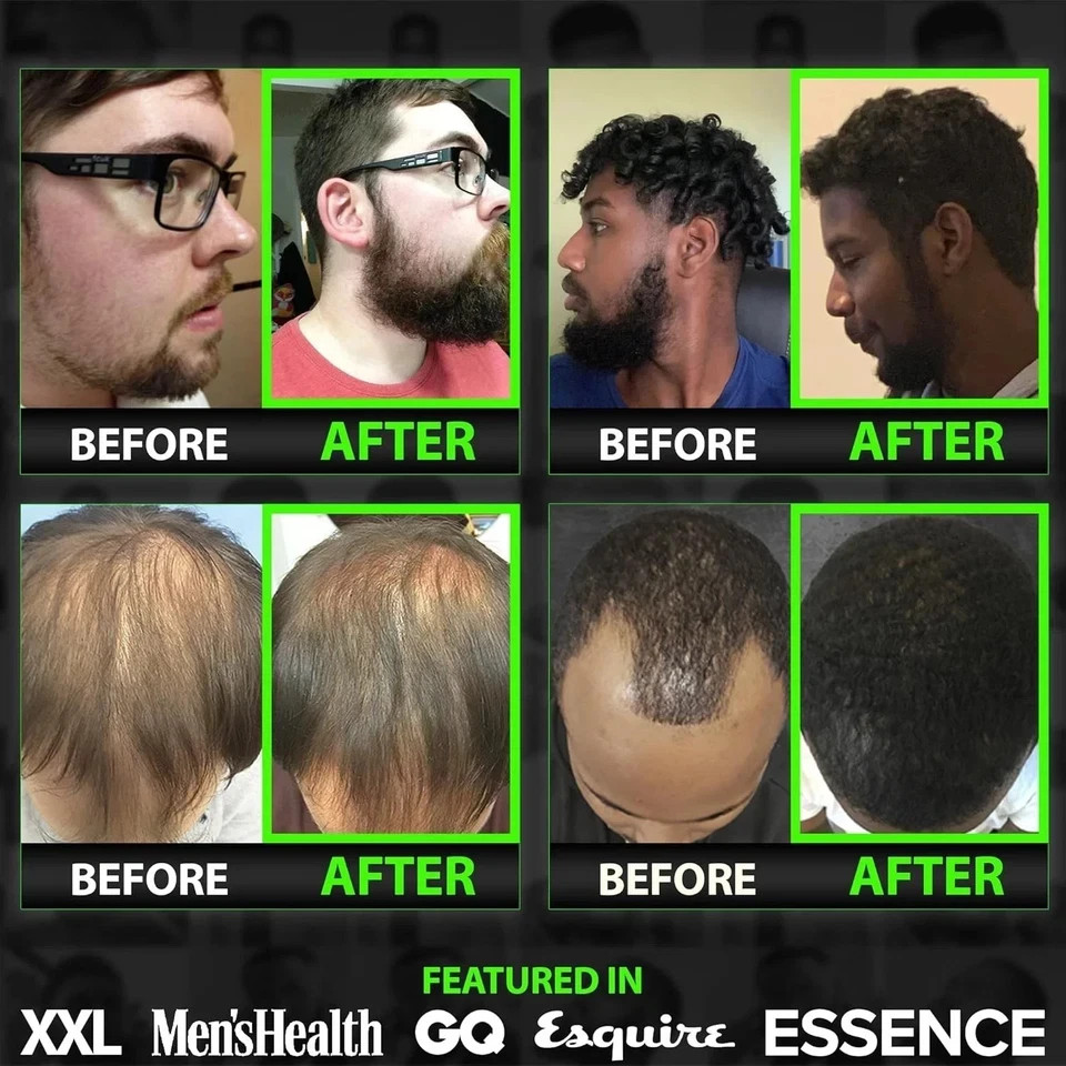 Beard Growth Serum – GROW Maximum XXL Beard Growth Oil for Men -Thickens & Fills