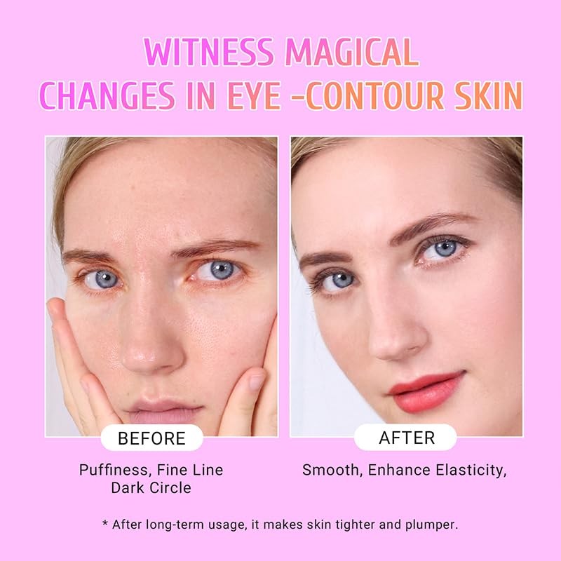 PEAUAMIE Under Eye Patches Gold and Hyaluronic Acid for puffy eyes,Rose Eye Mask