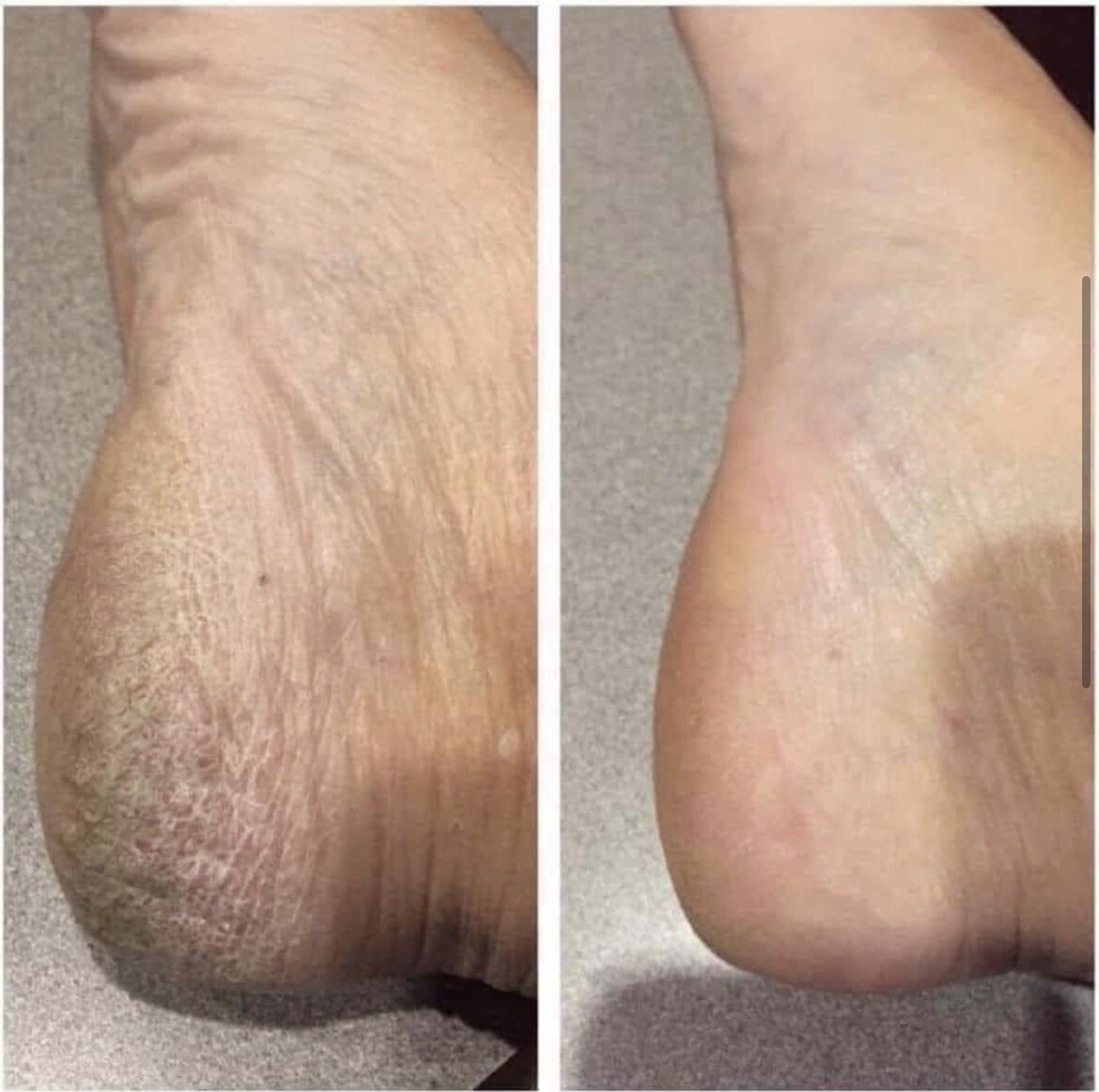Nu Skin Nuskin Epoch Sole Solution Foot Treatment 4. floz Exp03/2025