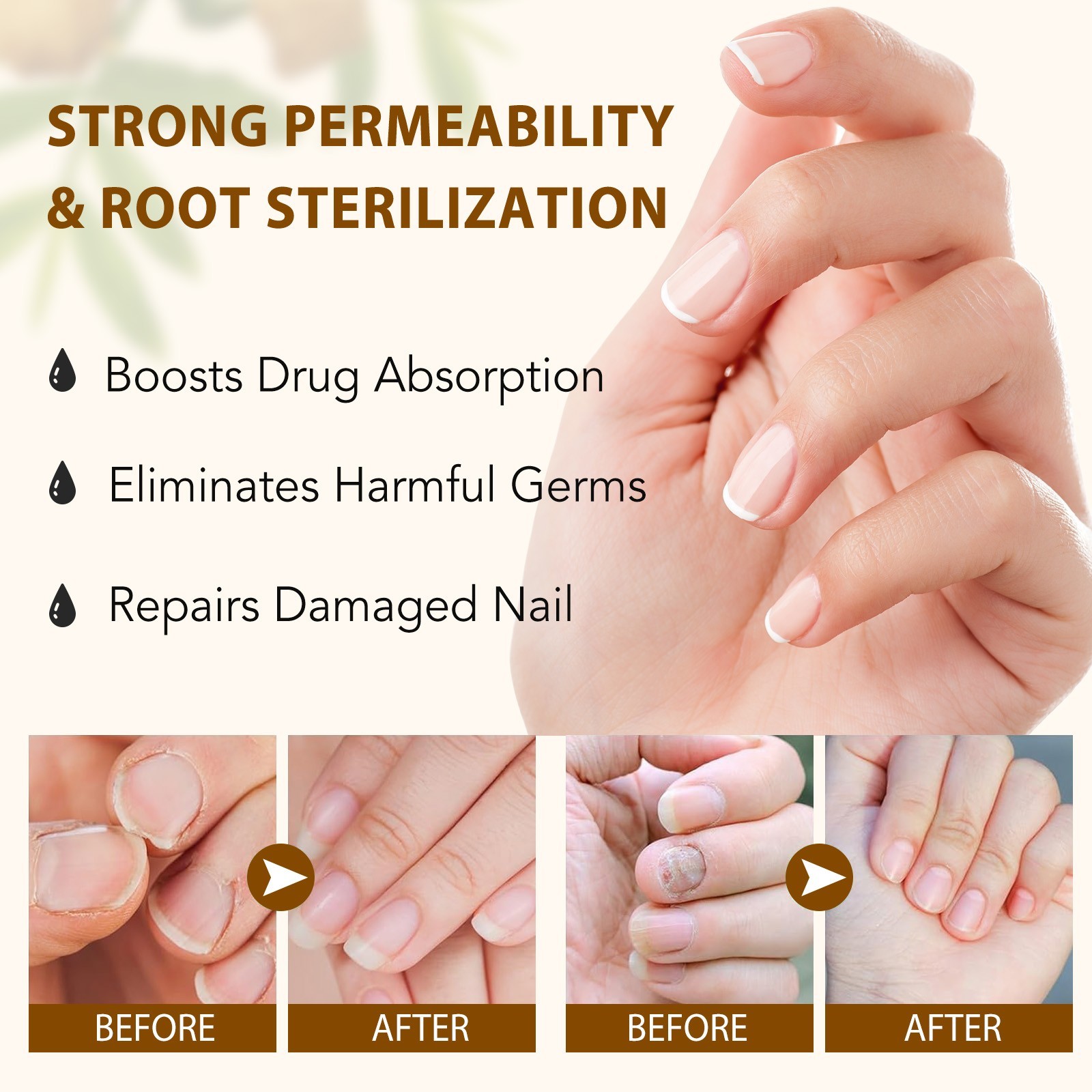 7 Days Nail Fungus Treatment – Extra Strength Repair for Nails & Cuticles 60ML