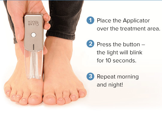 ClearTouch at Home Phototherapy Treatment for ToeNail Fungus – Brand New in Box