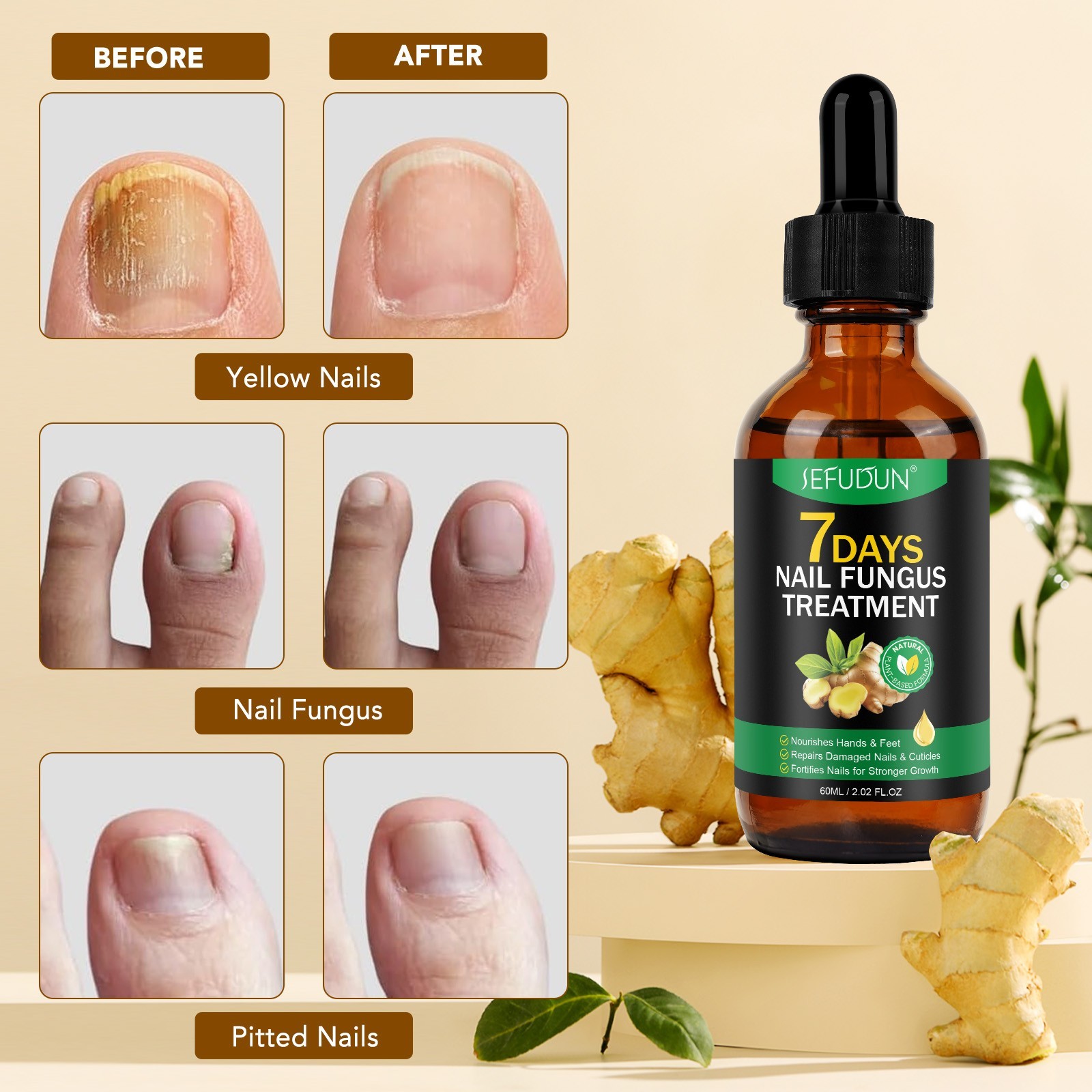 7 Days Nail Fungus Treatment – Extra Strength Repair for Nails & Cuticles 60ML