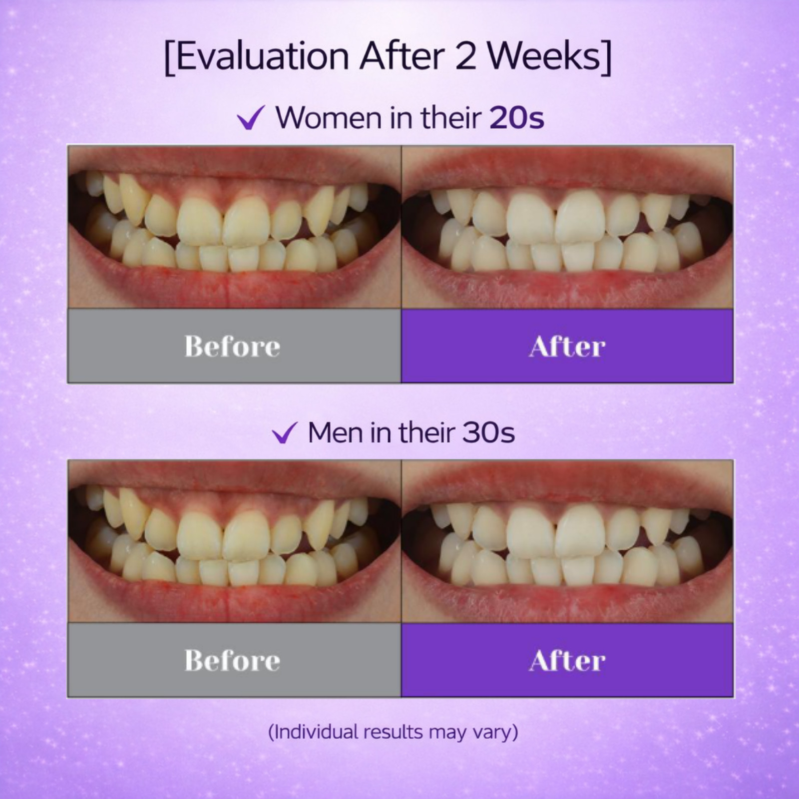 EUTHYMOL Whitening Purple Corrector Toothpaste 106g Fluoride Fresh Breath