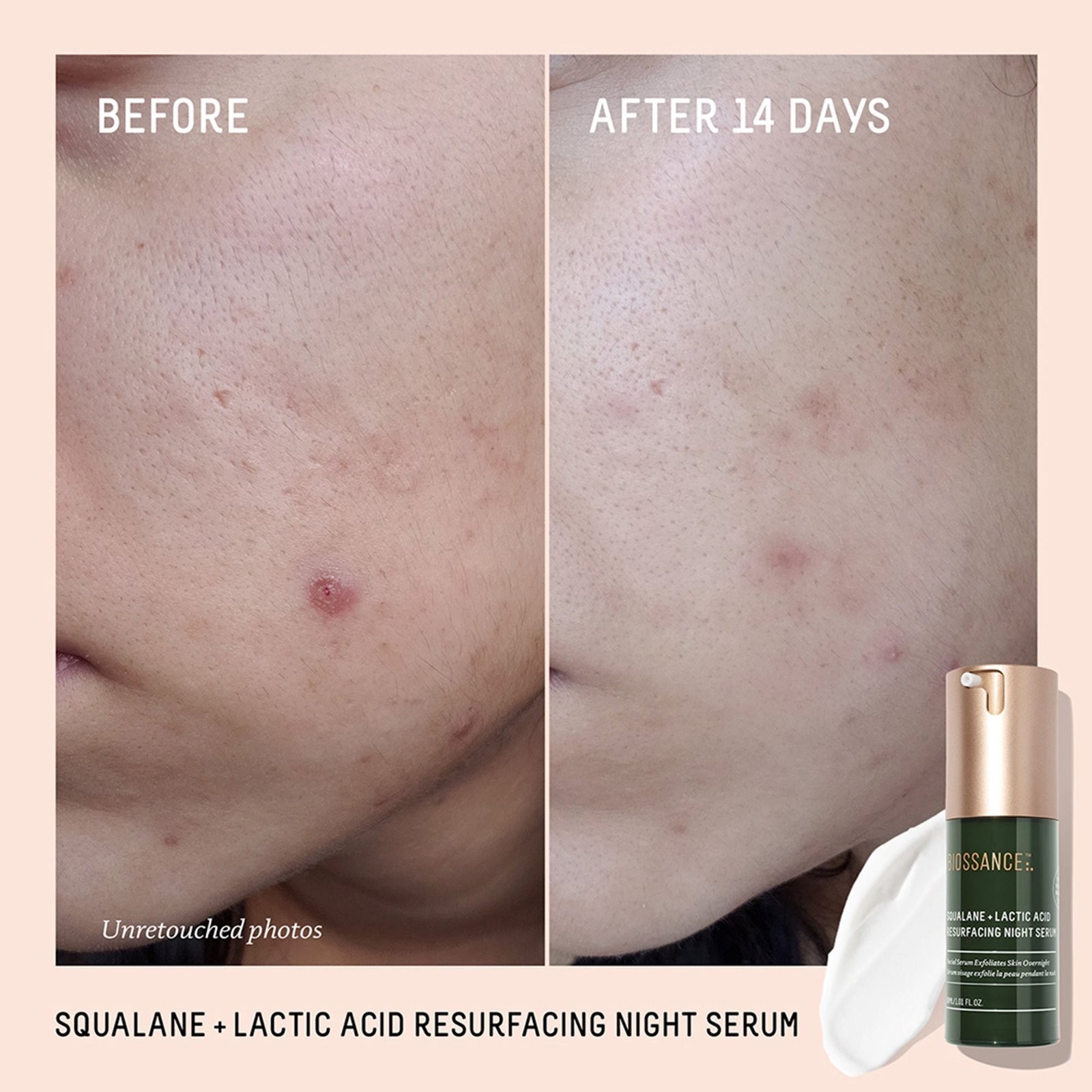 Clarifying Core Routine