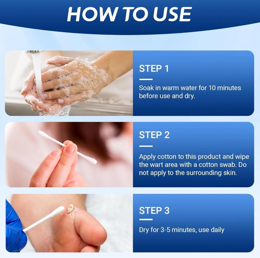 Wart Relief Cream for Genital, Plantar, Common, Flat & Filiform Warts