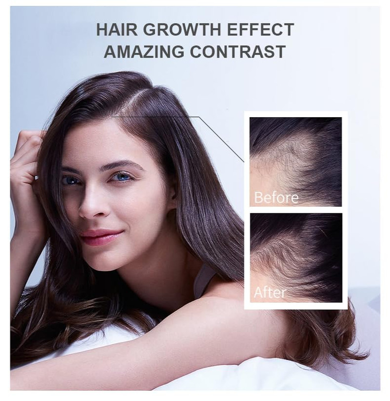 King of Ginger Oil for Hair Growth – Biotin Hair Growth Serum, 100% Pure Natural