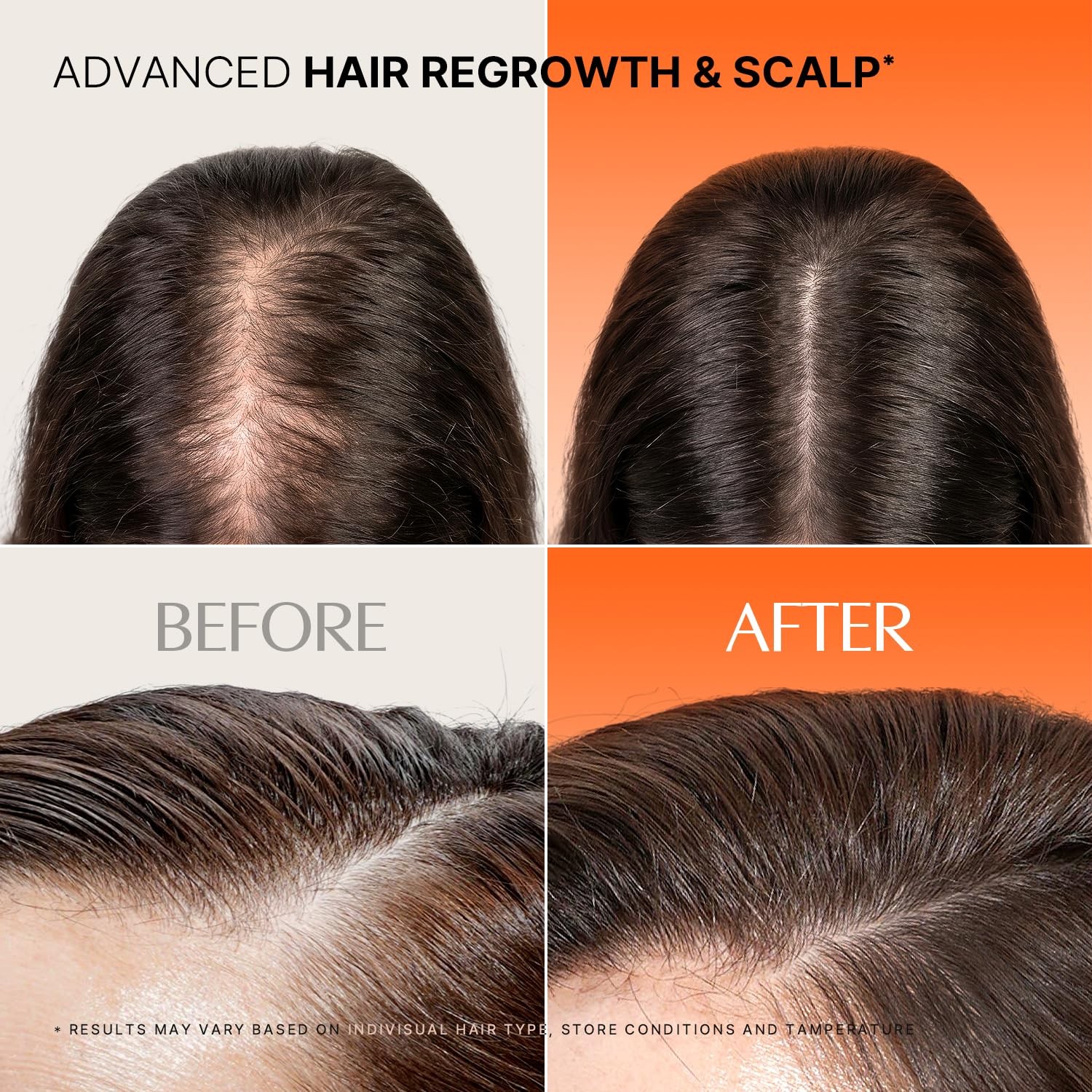 Lilyeve Growturn Exosome Spicule Ampoule 3000 Focused Hair Loss Scalp Solution