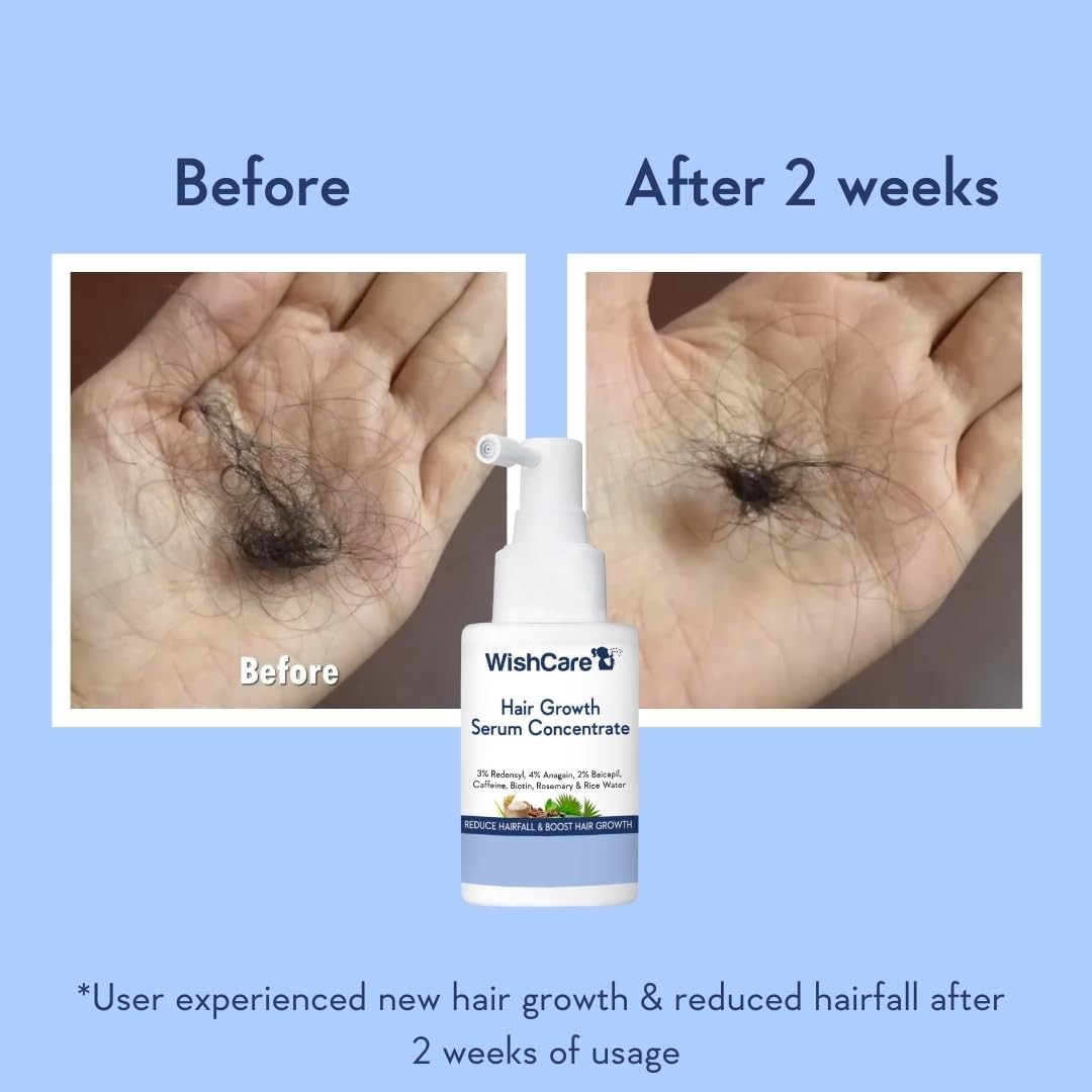 WishCare Hair Growth Serum For Scalp | 94% Saw New Hair Growth | 30ml