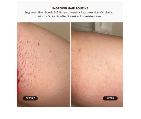 NIB Lmtd. Edition Bushbalm Ingrown Hair Exfoliating Scrub in Vanilla Sandalwood
