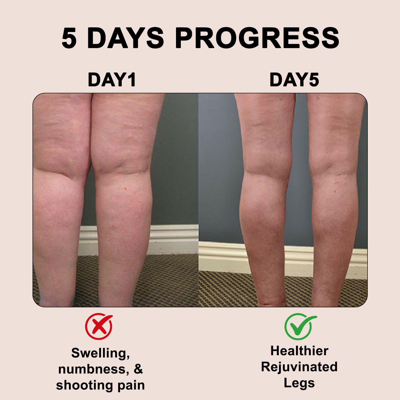 Senzio Herbal Balm Swollen Legs Nerve Discomfort Circulation Support