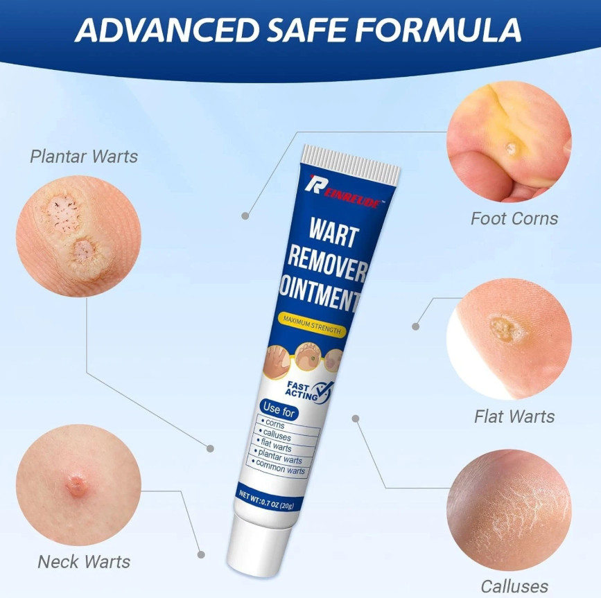 Wart Relief Cream for Genital, Plantar, Common, Flat & Filiform Warts