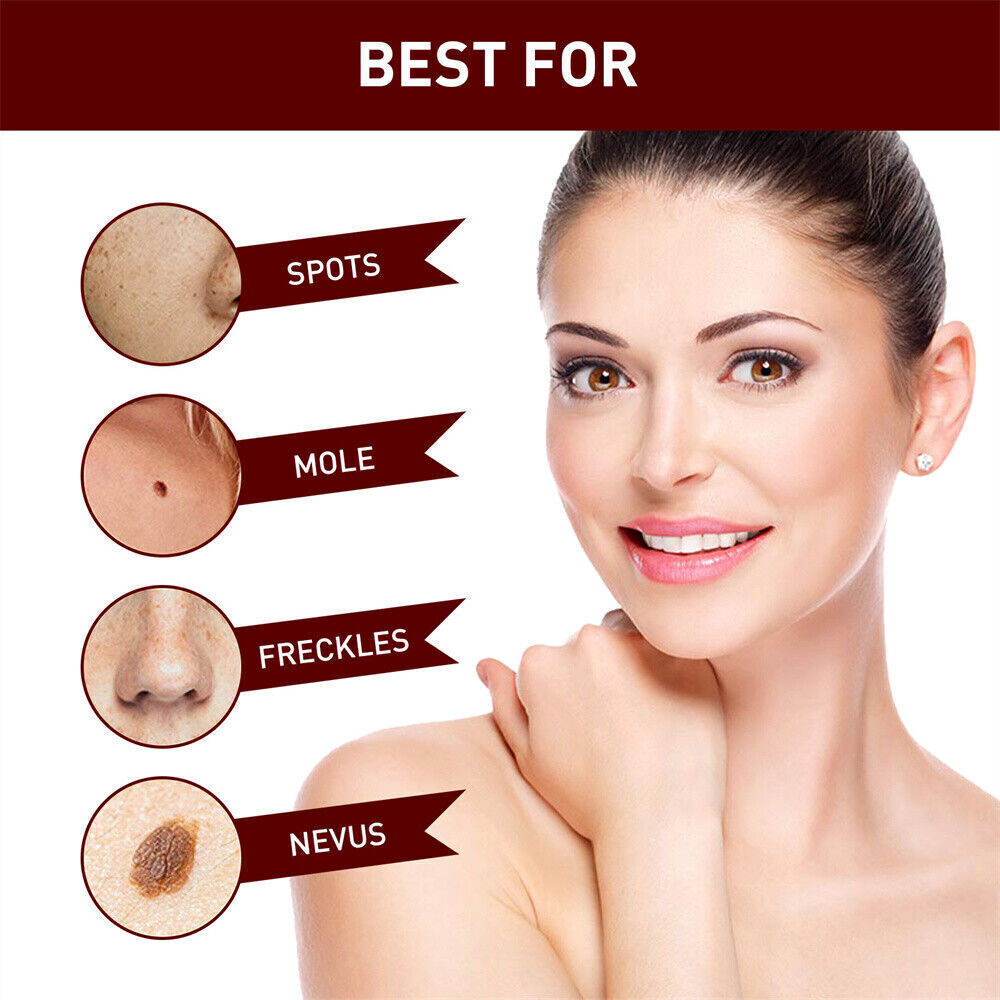 «FINAL SAL» Skin Tags & Moles Removal Quick Safe Remover Restore Skin 3ml US