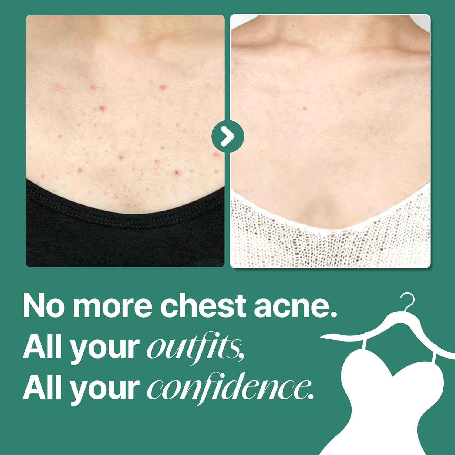 SOME BY MI AHA BHA PHA 30 Days Miracle Acne Clear Body Cleanser – 13.5oz, 400ml