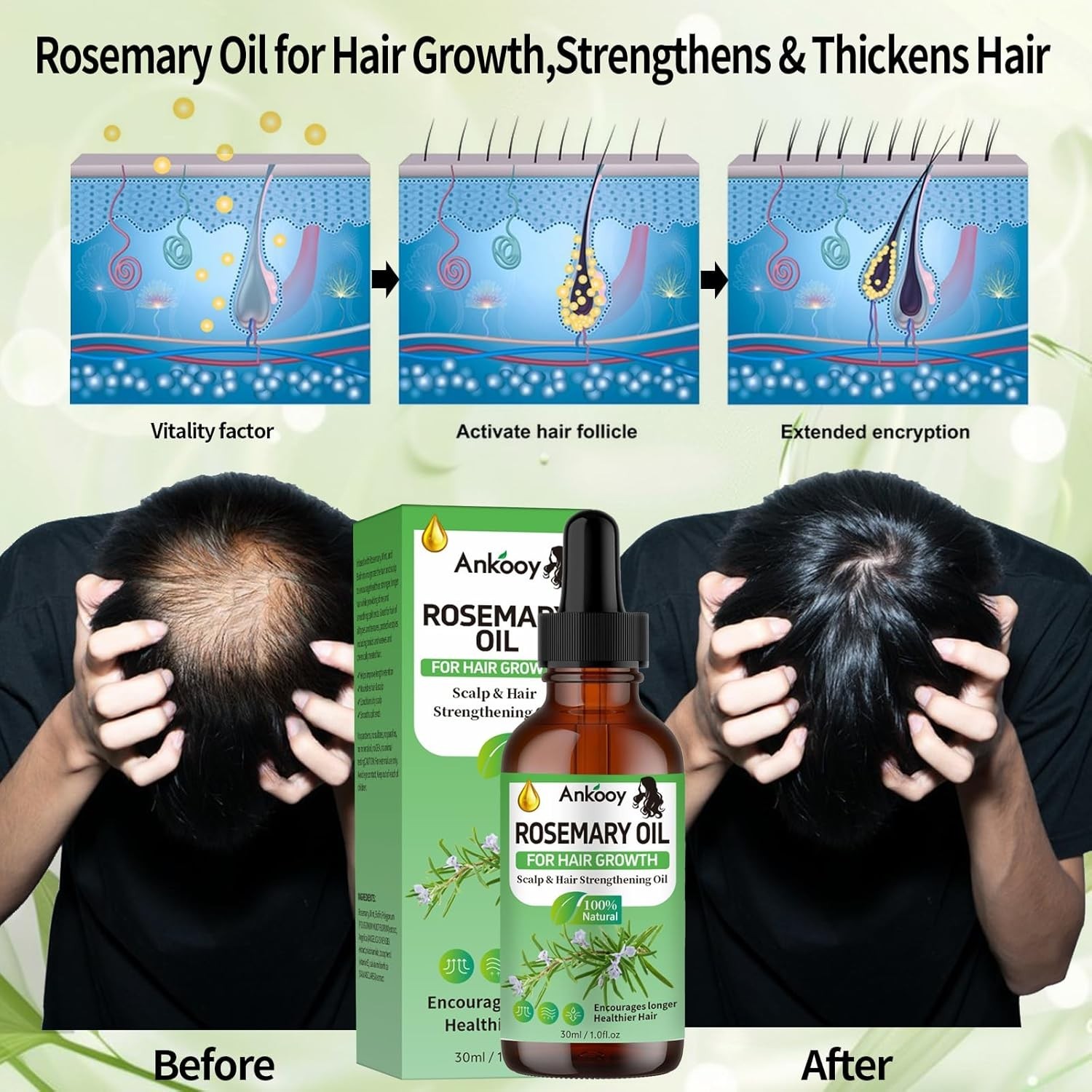 3 Pack Rosemary Oil for Hair Growth,Rosemary Hair Growth Oil,Strengthening Oil f