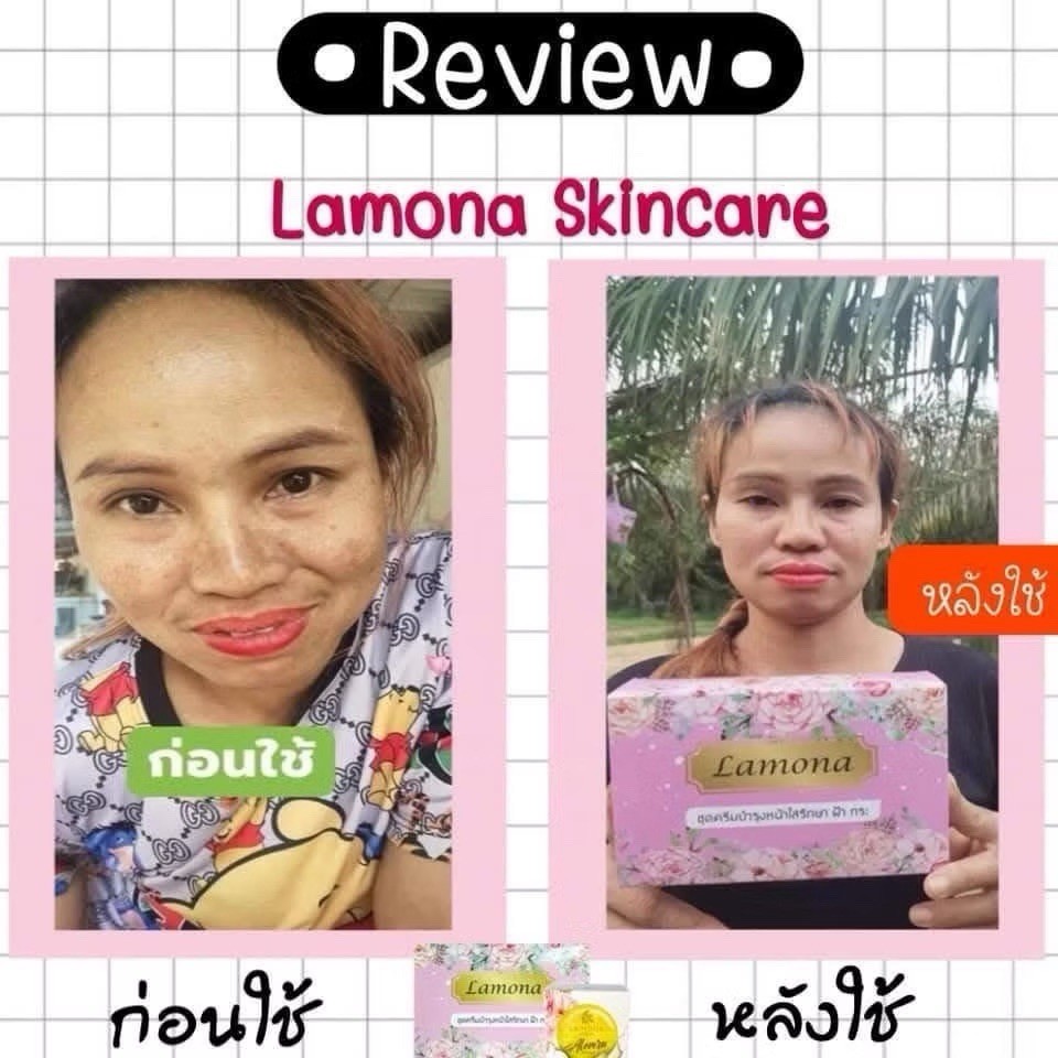 Lot 10 Box Lamona Cream Skincare Set 4 Pieces Facial Cream & Serum Set