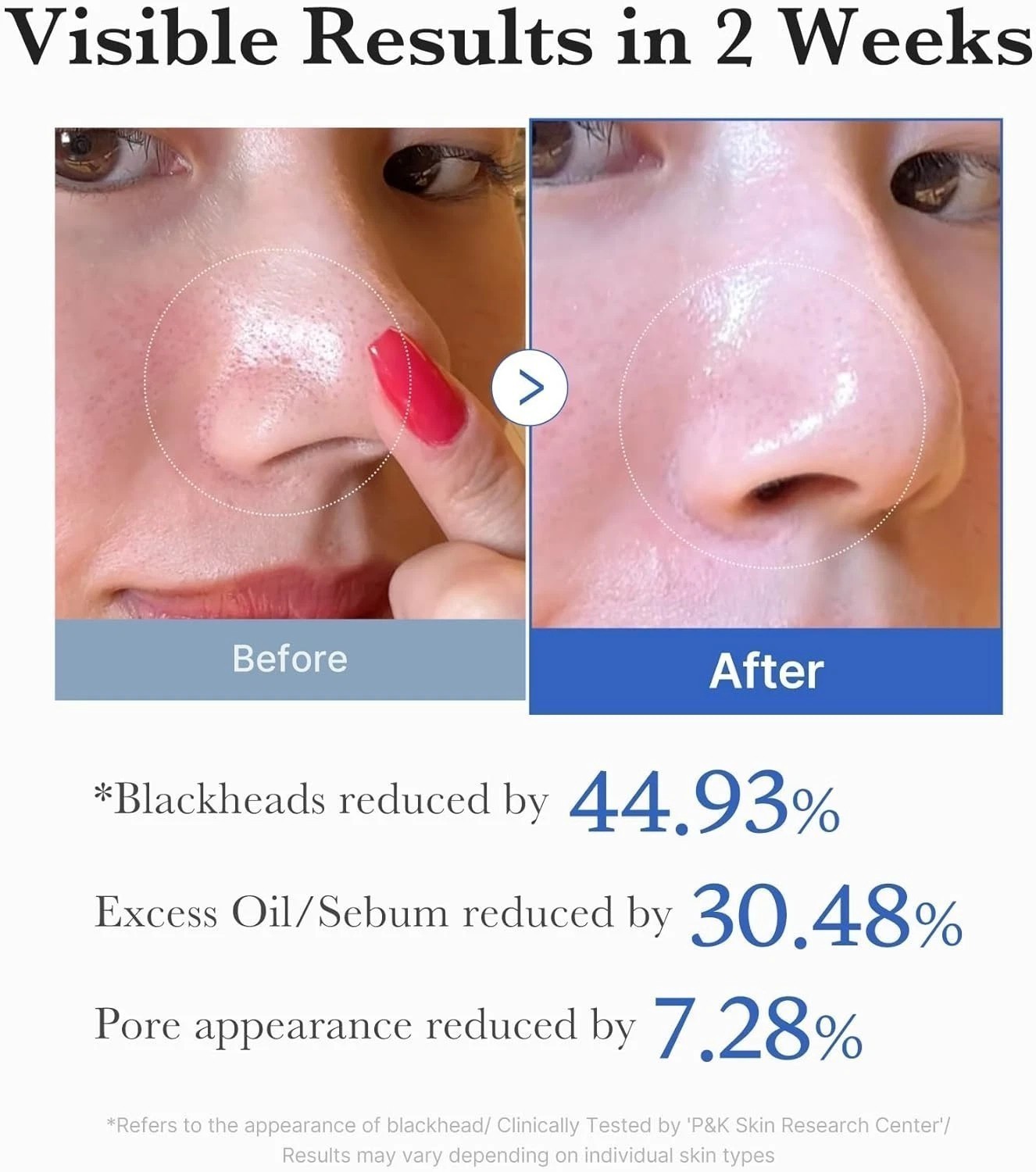 MediCube Zero Pore Pad 2.0 | Dual-Textured Exfoliating Toner Pads,Pore Refining