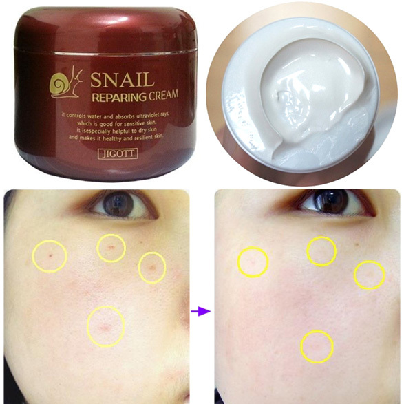 KOREA BEST SKIN CARE Whitening Cream + Snail Cream + Collagen Cream Moisturizer