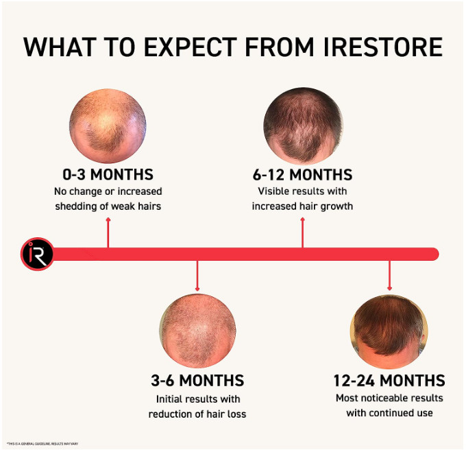 iRESTORE Essential Laser Hair Growth System – Reconditioned – ID-500