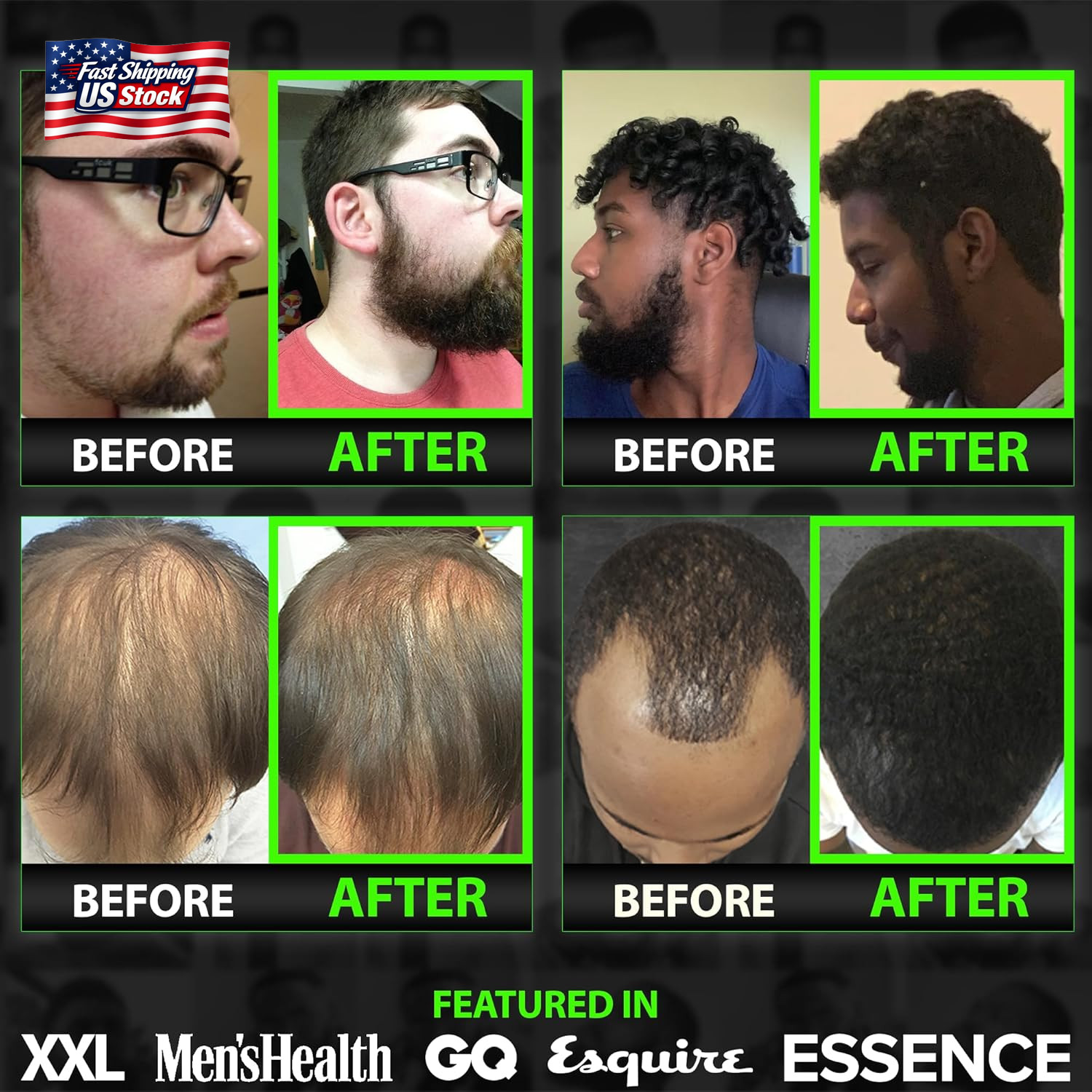 Beard Growth Serum – GROW Maximum XXL Beard Growth Oil for Men -Thickens & Fills