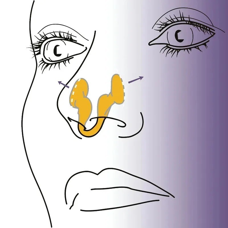 Anti Snore Nose Clips – Nasal Dilator for Snoring Improve Sleep Quality