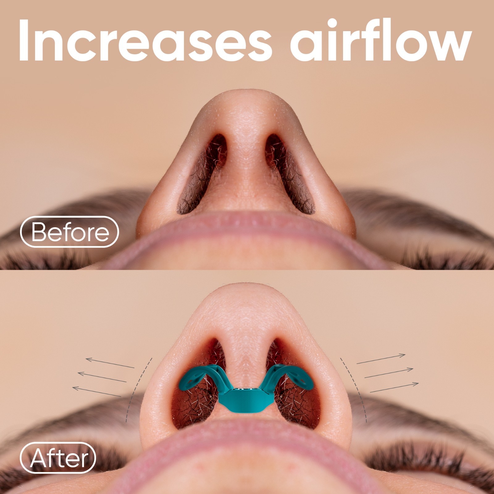 Nasal Dilators – Nose Vents Opener for Better Breathing