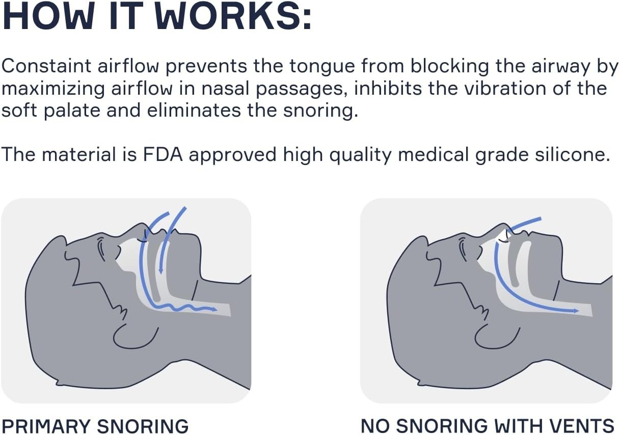 Nasal Dilators for Sleeping – 4 of X-Large ONLY (XL) Soft Silicone Nasal Cones –