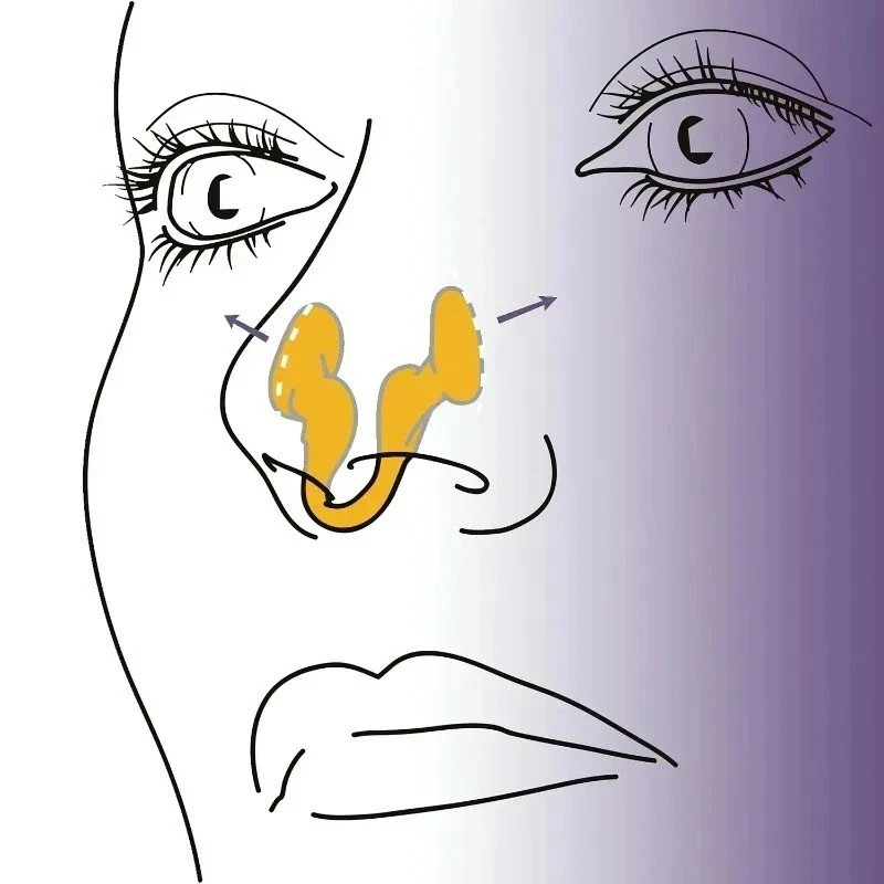 Anti Snore Nose Clips – Nasal Dilator for Snoring Improve Sleep Quality