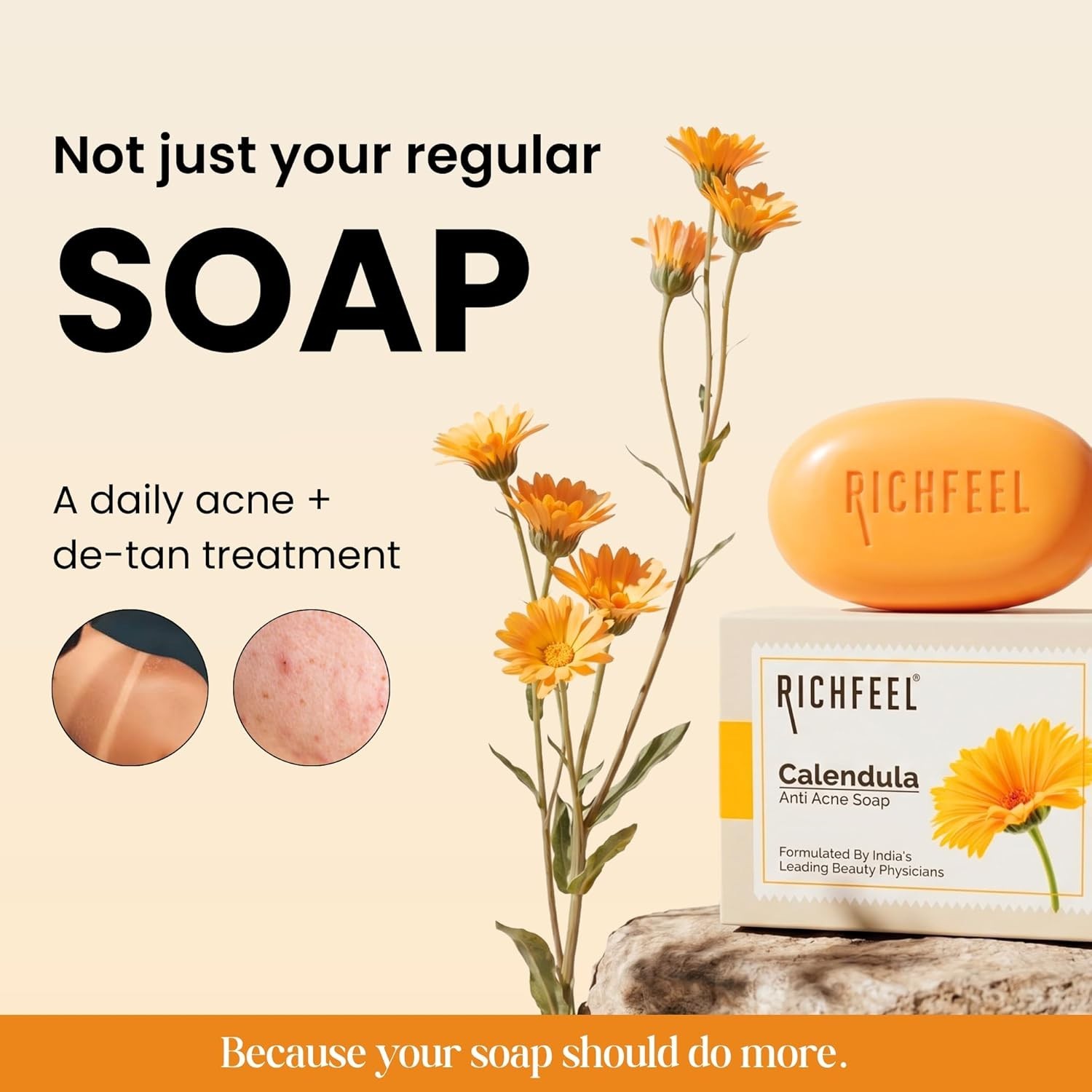 Richfeel Calendula Acne Soap, 75g (Pack of 3)