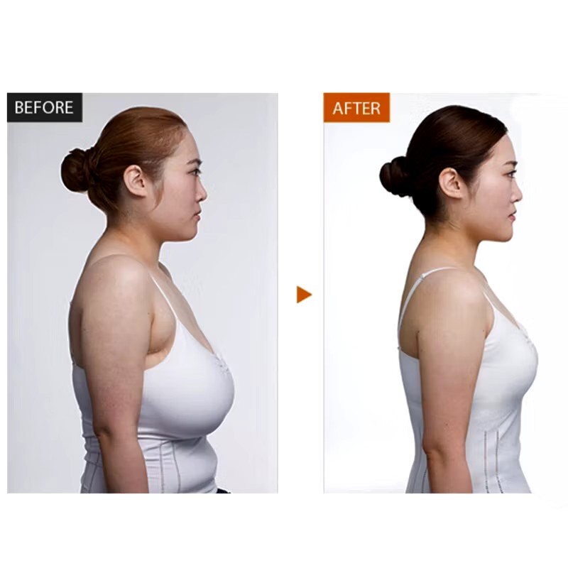 Breast Reduction Serum 10ML For Reducing Breast Size To Small, Firming & Lifting