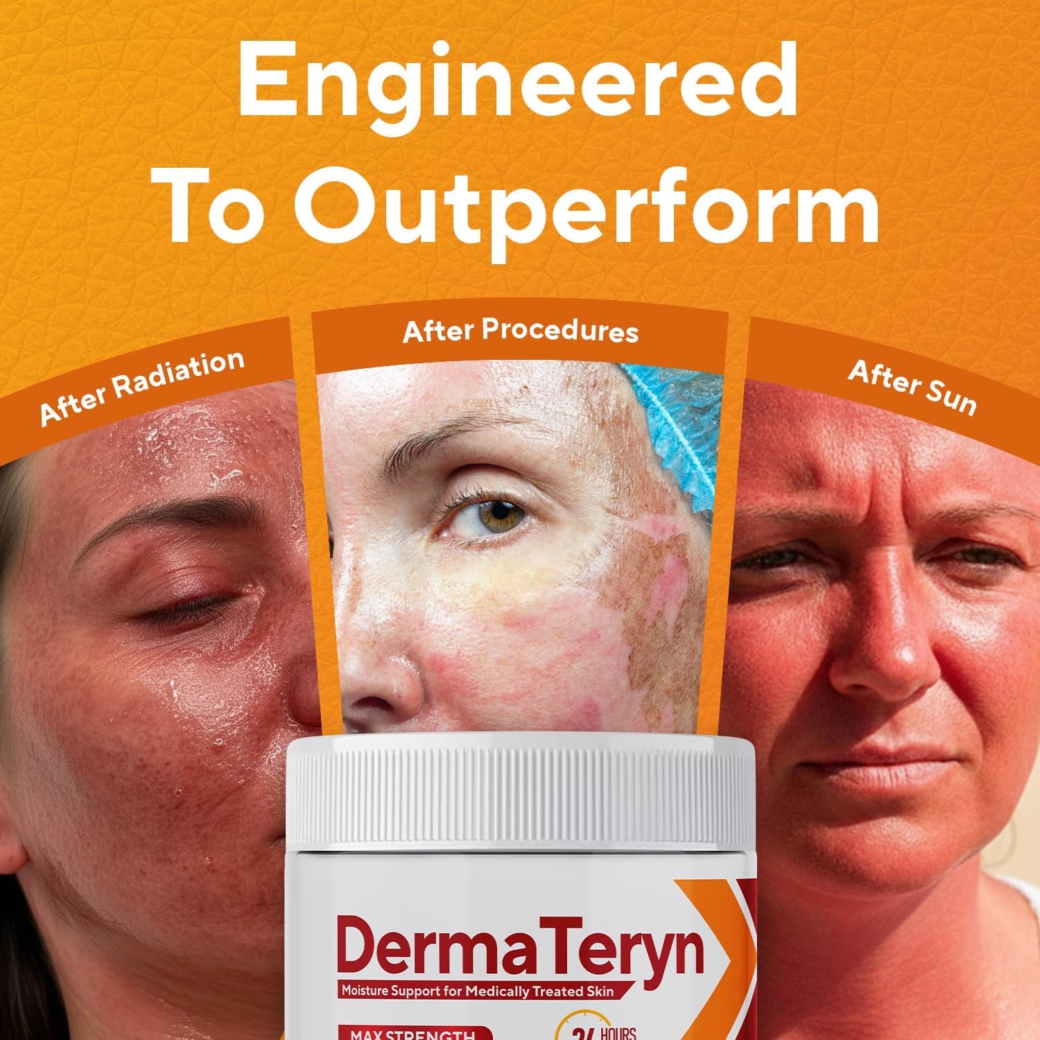 Marie Originals DermaTeryn for Skin Moisture, Sunburn, Skin Repair Treatmen 4 oz