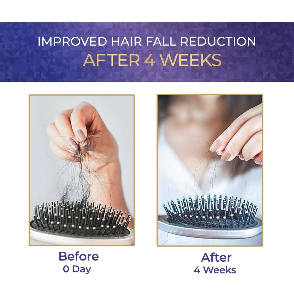 Streax Hair Growth Serum for Scalp, 30 ml with 3% Redensyl, 3% Anagain