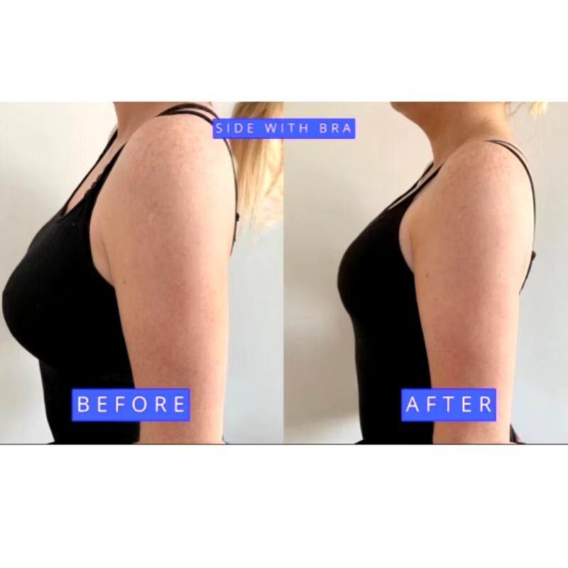 Breast Reduction Serum 10ML For Reducing Breast Size To Small, Firming & Lifting