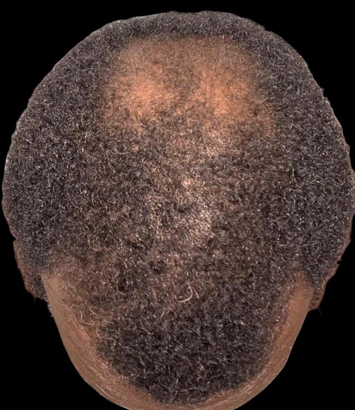 Lil Momma’s The Juice ( Hair Growth Oil)