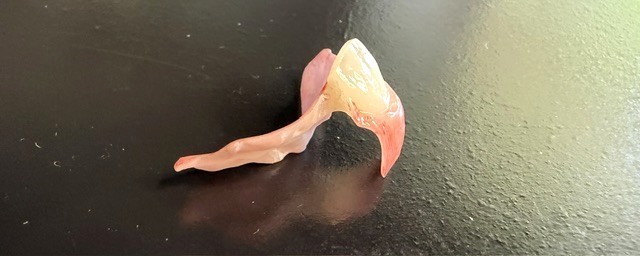 Acrylic Denture Flipper – Custom Fitted