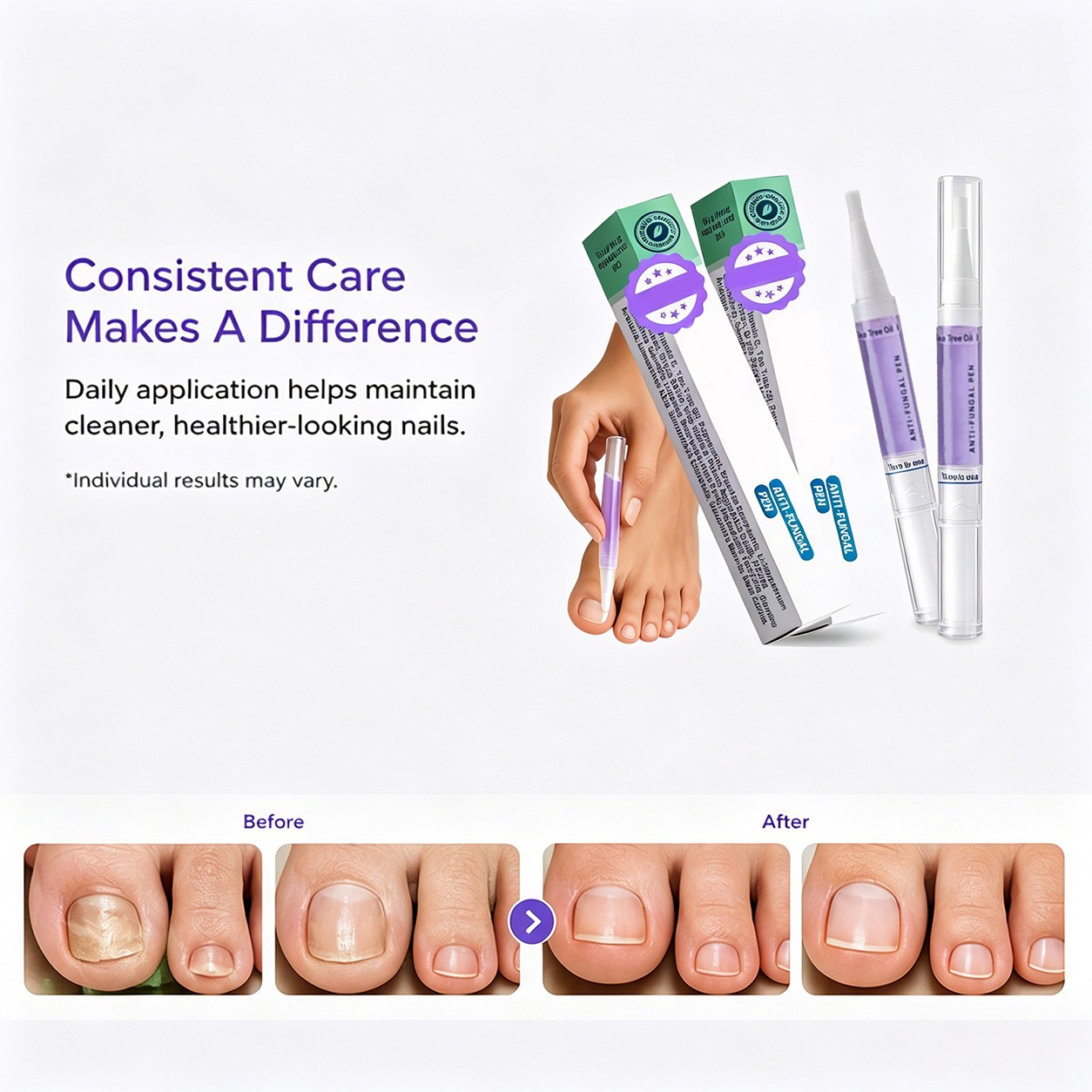 Orivelle Anti Pen, Clear Anti Fungal Pen, Anti Fungal Nail 3ml*3PCS