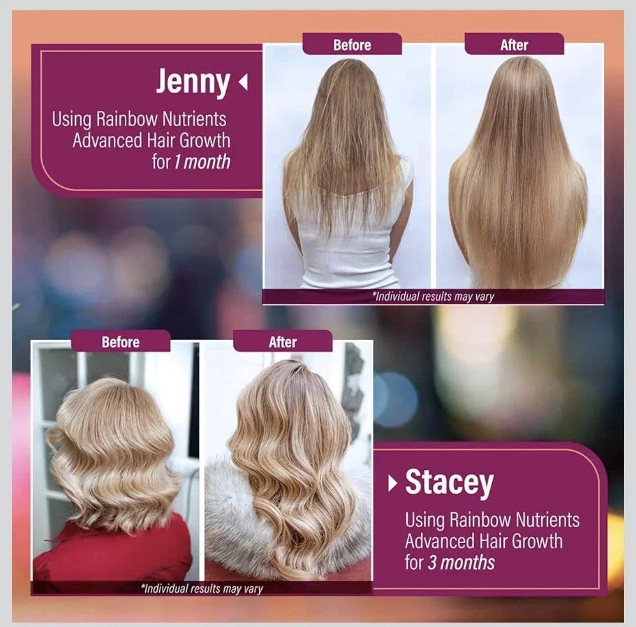 Hair Growth Complex | Biotin Collagen Supplement Prevents Hair Loss & Improves