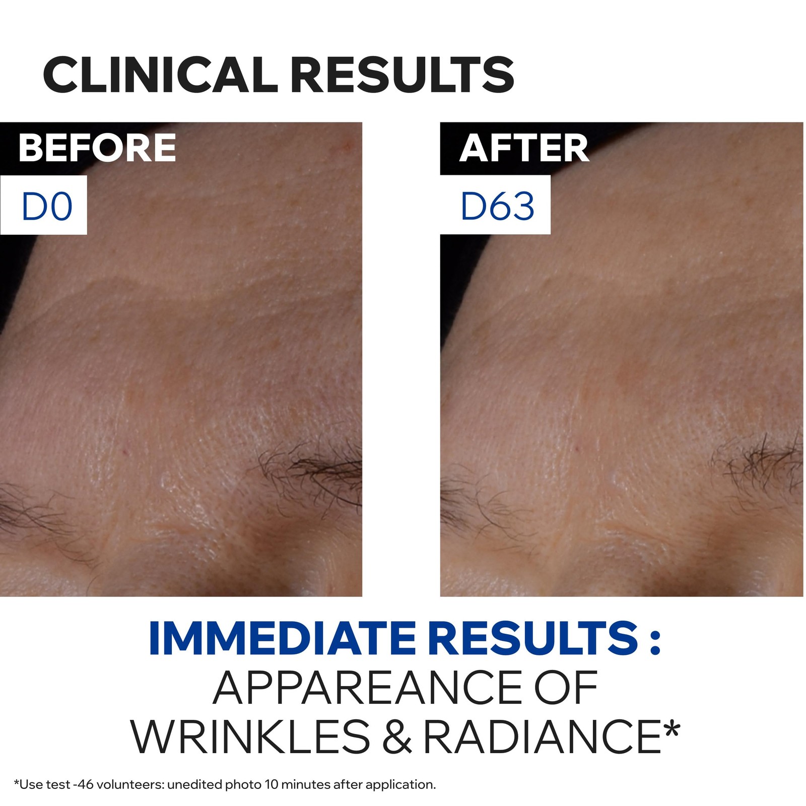 Uriage Age Absolu Redensifying Night Care Visibly Reduces Wrinkles Plumps Skin