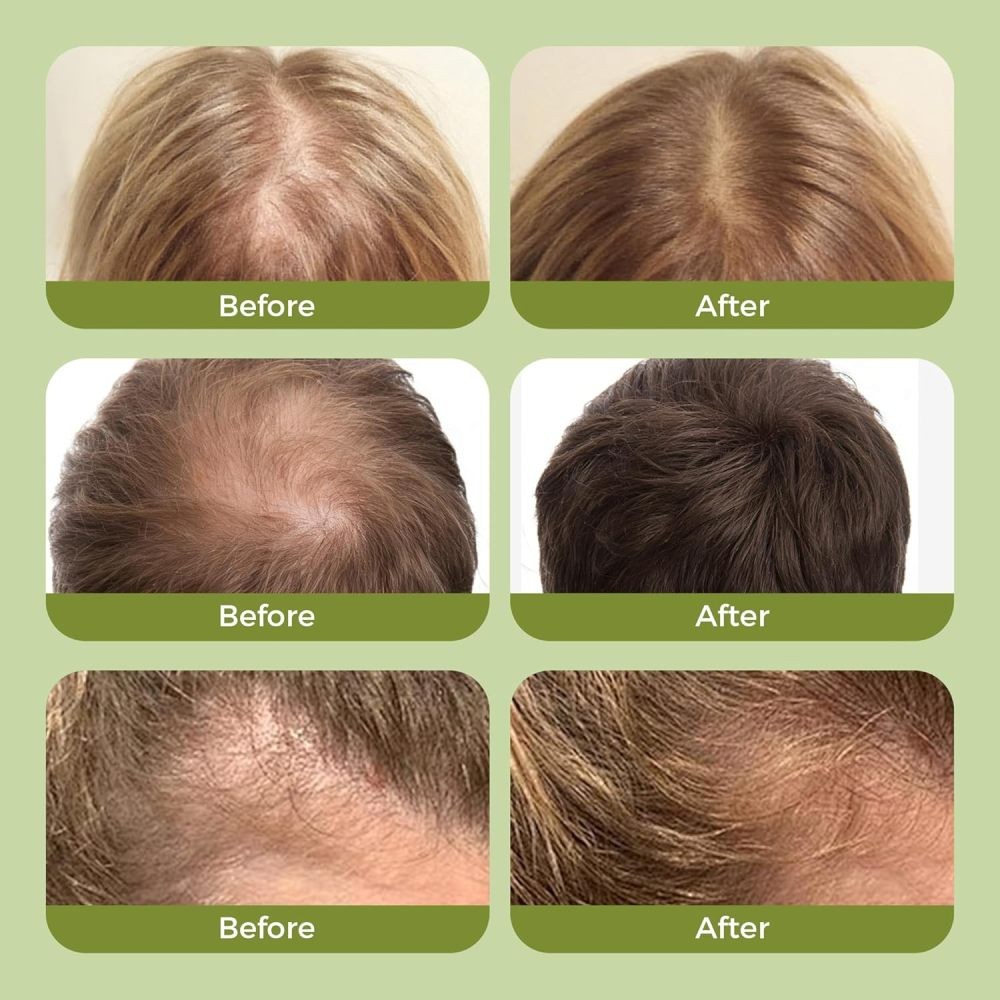 3PCS Organic Rosemary Hair Growth Shampoo for Natural Thickening & Strengthening
