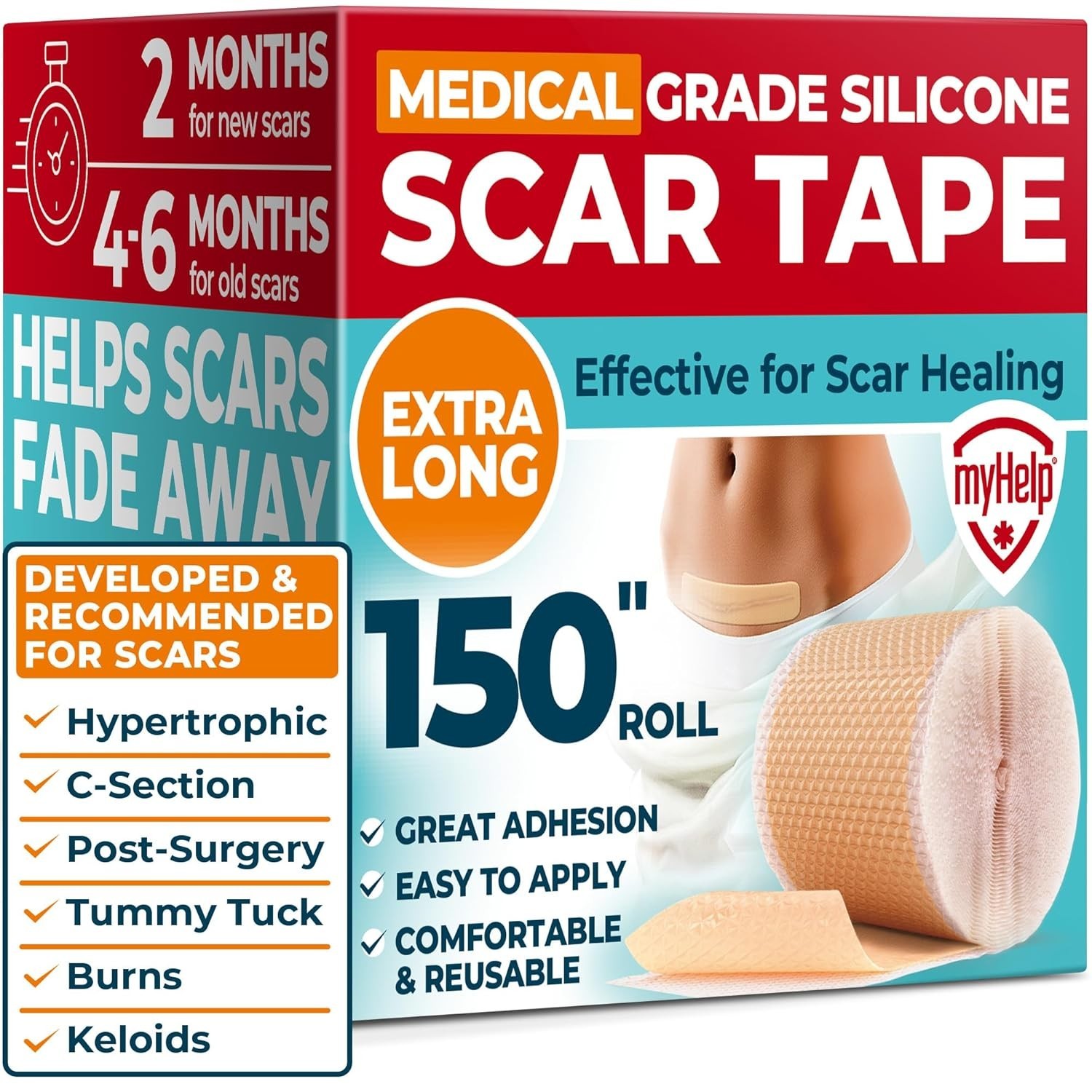 Medical Grade Silicone Scar Tape – 1.6”x150” – Visible Difference on Keloid &…